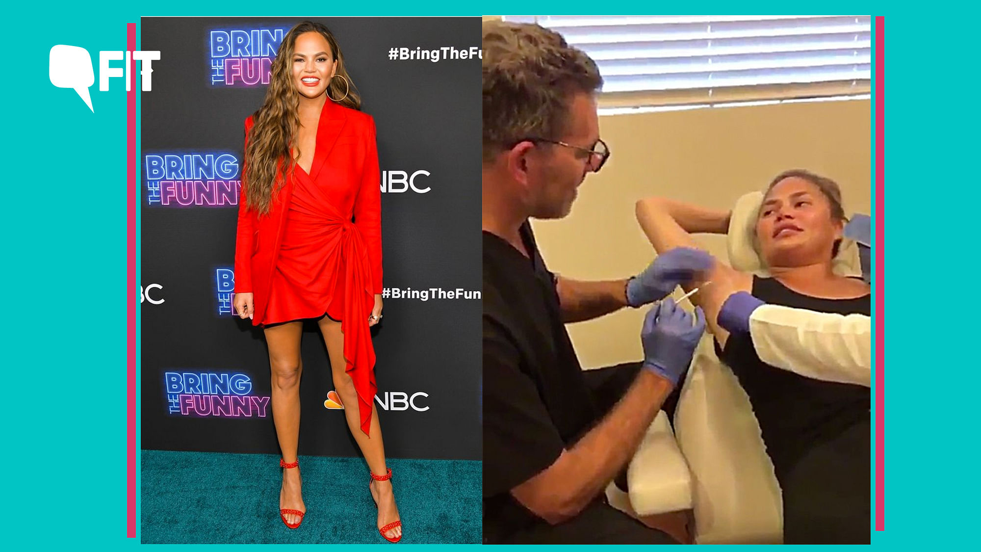 Chrissy Teigen recently got Botox done in her armpits to prevent excess sweating