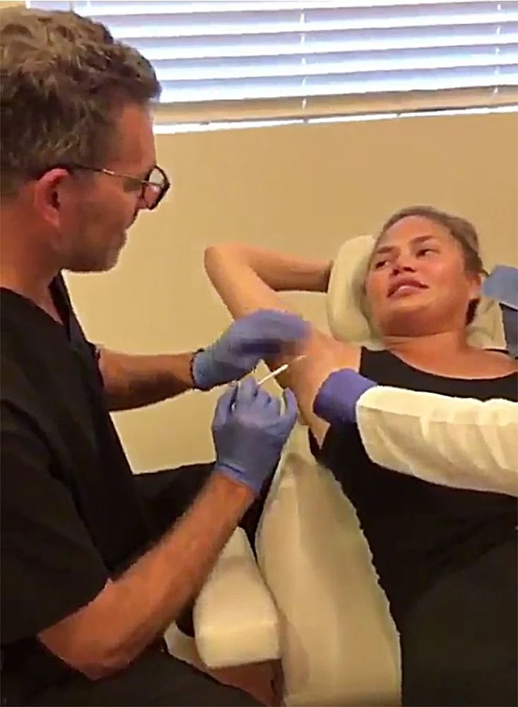 Chrissy Teigen says she did not feel too much pain, as her “pain tolerance might be quite high.”