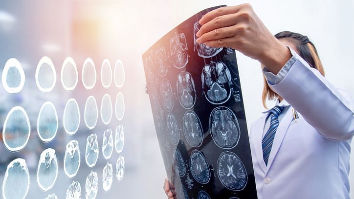 Stock photo of a doctor holding an MRI scan for brain injury
