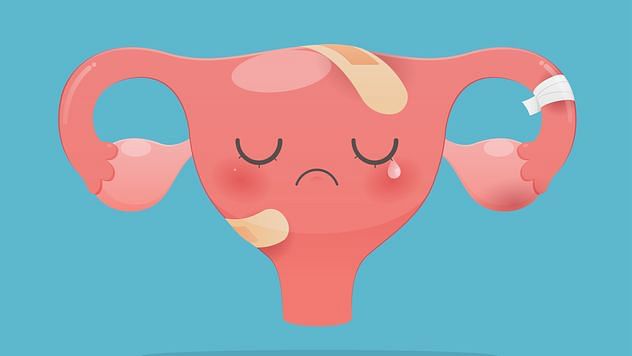 PCOS can end up making a uterus rather sad!&nbsp;