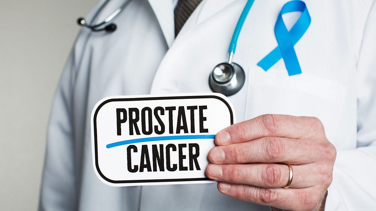Prostate cancer is the fourth most widespread cancer in the world, say researchers.&nbsp;