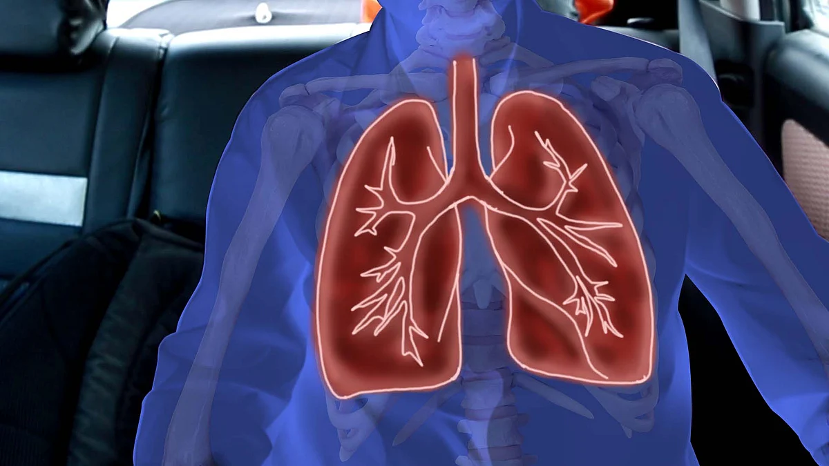 Chronic Obstructive Pulmonary Diseases can kill 