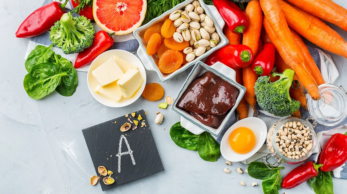 Overdose of vitamin A supplements could lead to toxicity or hypervitaminosis A.