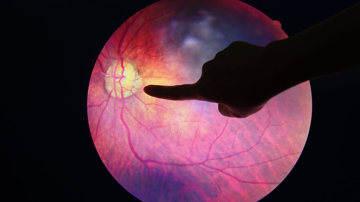 Diabetic Retinopathy: How Diabetes Impacts Your Eyes
