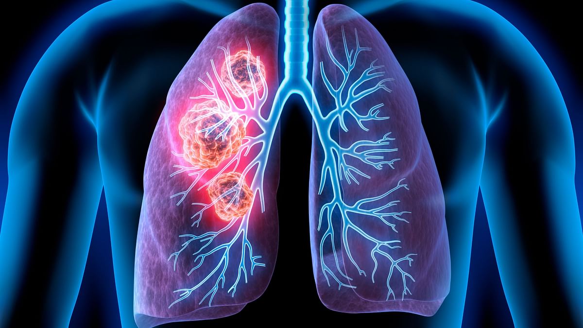 10 Ways to Reduce the Risk of Lung Cancer