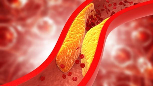 Immune Response to COVID-19 May Hold Key to Blood Clot Risk: Study