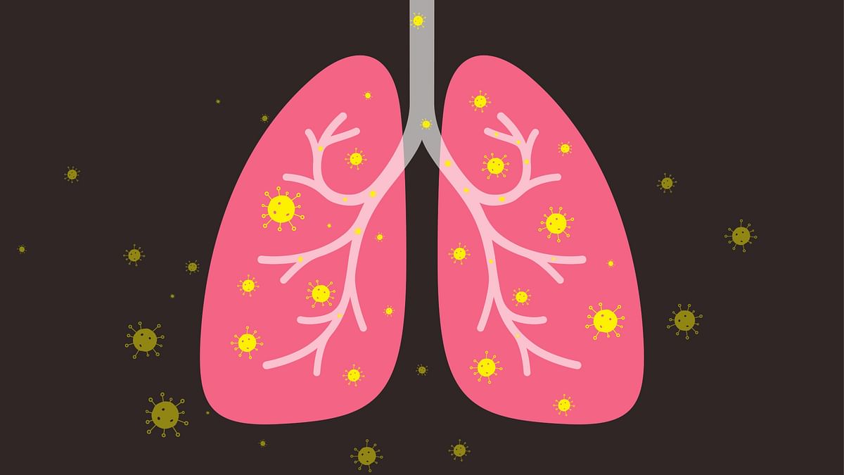 Pneumonia: Causes, Symptoms, Diagnosis and Treatment 