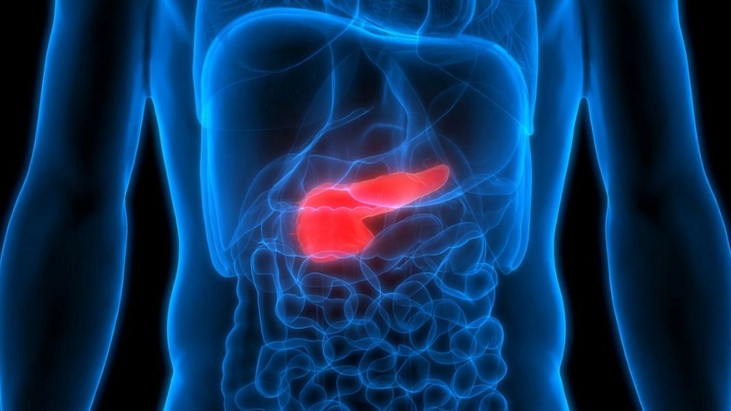 <div class="paragraphs"><p>Know the symptoms, causes, stages, and treatment of pancreatitis.</p></div>