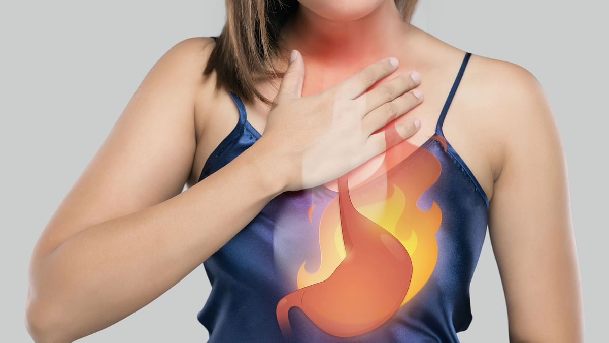 10 Foods That Can Help Beat Heartburn Naturally