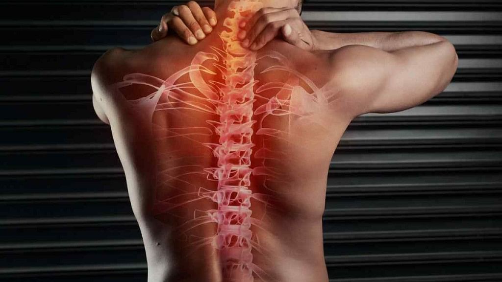 एंकिलोसिंग स्पांडिलाइटिस गठिया का एक सामान्य प्रकार है, जिसमें रीढ़ की हड्डी प्रभावित होती है और पीठ में दर्द होता है