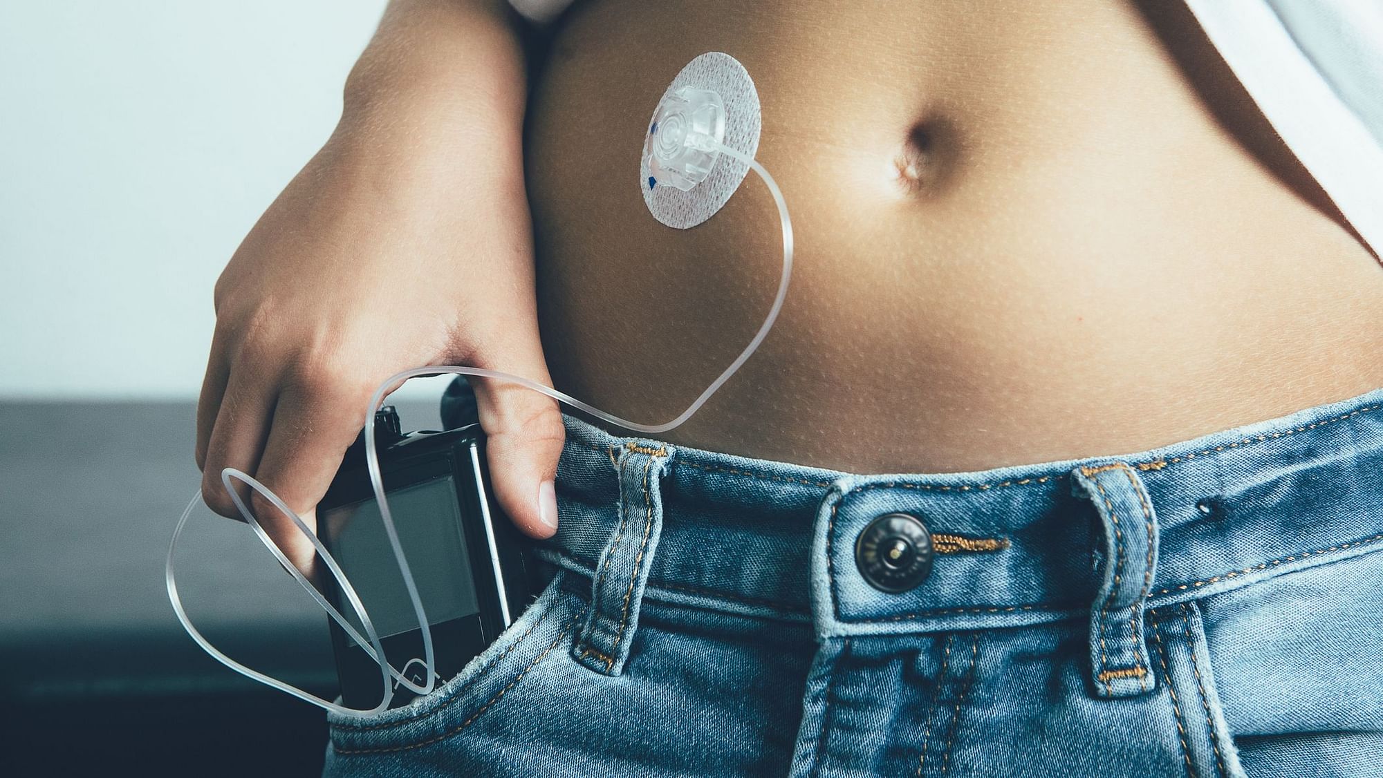 Some Medtronic Insulin Pumps May Pose Cybersecurity Risk