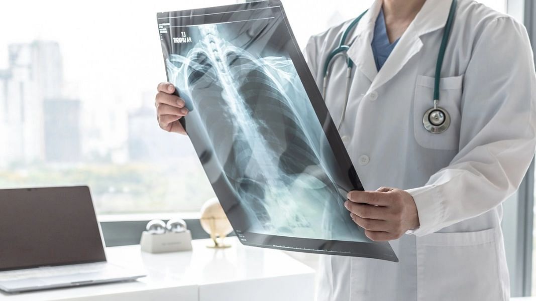 World Radiography Day 2021 History, Significance, Theme for 2021