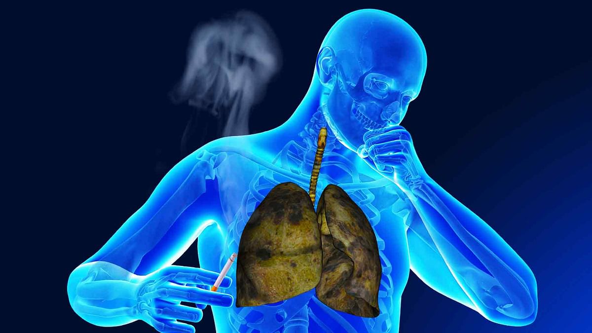 what-s-smoker-s-cough-symptoms-cure-treatment-smoker-s-cough