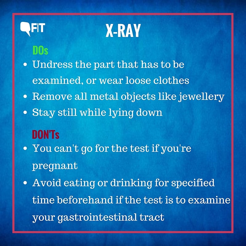 Going for an MRI, CT Scan, XRay or Implants? Here Are Some DOs & DON’Ts