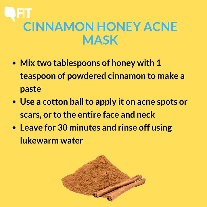Home Remedies Using Cinnamon From Healing Acne to Curing Cold 5 Home Remedies Using Cinnamon