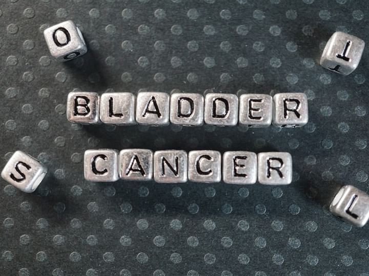 Bladder Cancer: Types, Causes, Symptoms, Diagnosis, Stages and Treatment