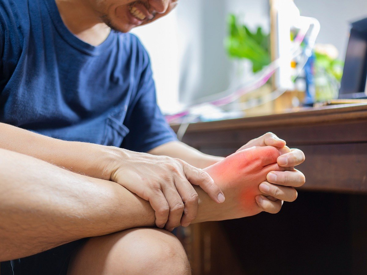 Tips to Manage Uric Acid Levels Naturally