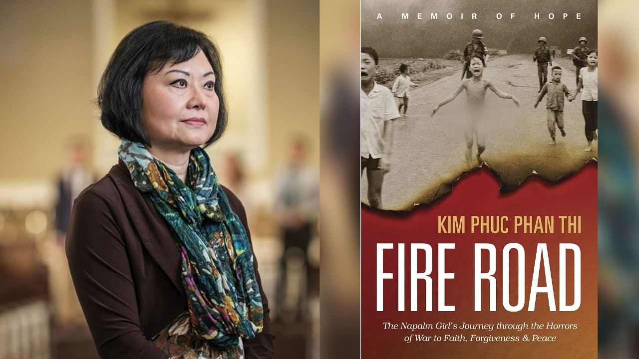 Vietnam Wars ‘napalm Girl Gets Final Skin Treatment Heres Her Story 