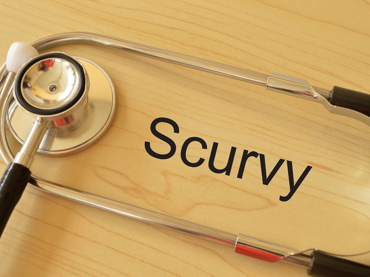 Scurvy Symptoms Causes Diagnosis And Treatment