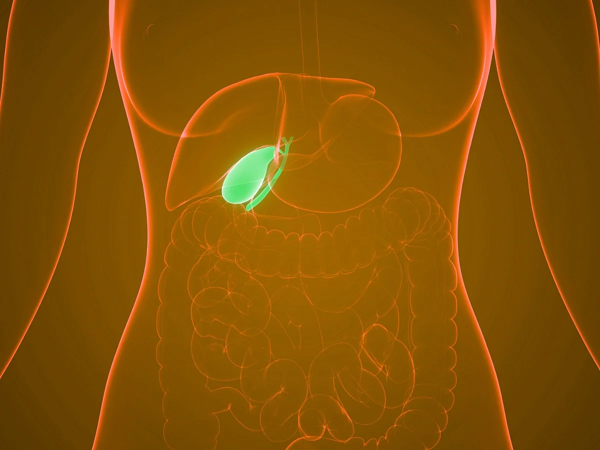 Gallstones: Symptoms, Causes, Risk Factors, Diagnosis, and Treatment