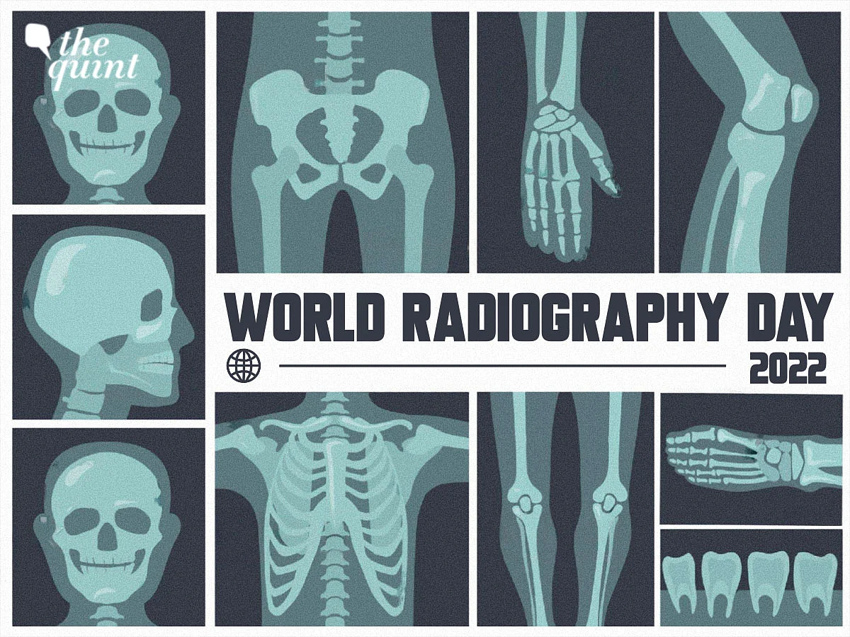 Am Radiographic World Radiography Day 2022: Theme, History & Significance