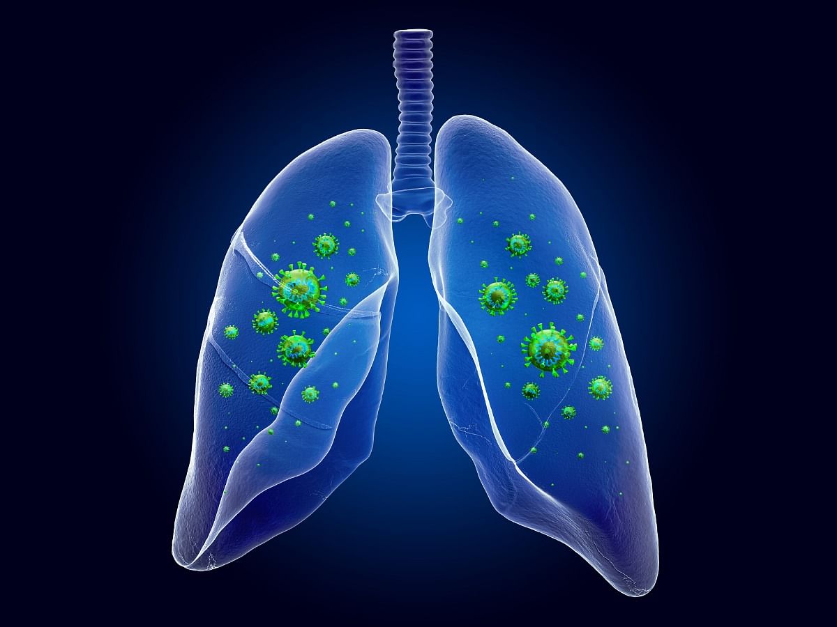 Bronchiolitis Symptoms Types Causes Diagnosis And Treatment