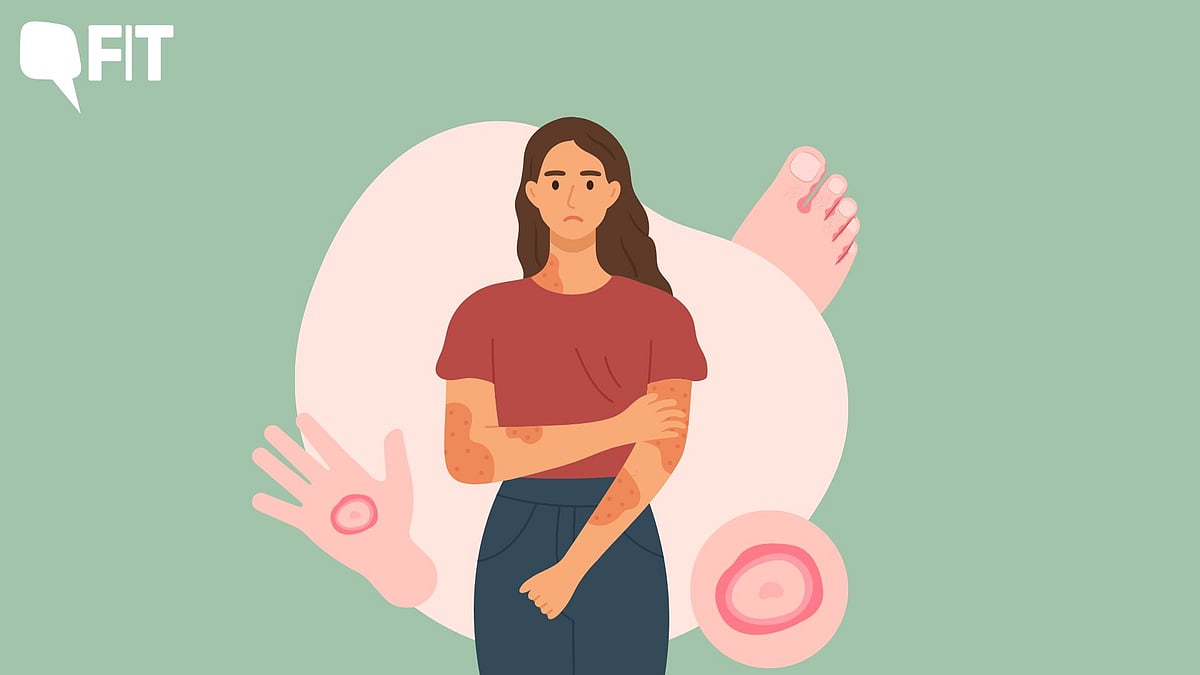 In Photos Does Your Skin Itch During Rains? Here's How You Can Prevent It