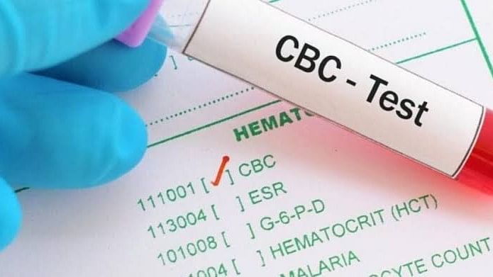 Understanding CBC Test Price And Importance In Blood Health   Thumbnail Pic Quint 3 